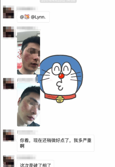 特應性皮炎苦不堪言 特應性皮炎苦不堪言