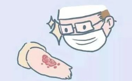 盛懷次氯酸水可治療慢性傷口 盛懷次氯酸水可治療慢性傷口